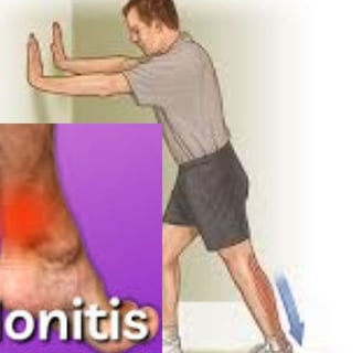 achilles tendon