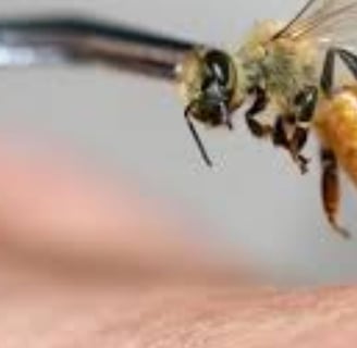 Bee Therapy the Benefits and Uses of Bee Venom (5)