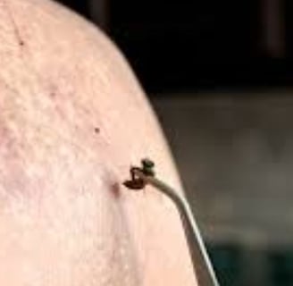 Bee Therapy the Benefits and Uses of Bee Venom (6)