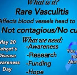 vasculitis