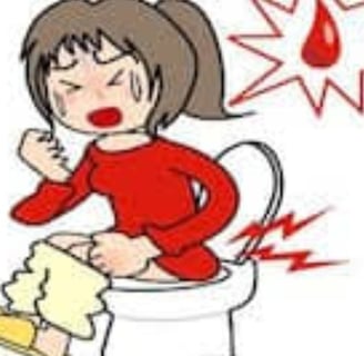 Bleeding Per Anus And Only Free Treatment