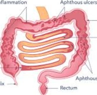 Bleeding Per Anus And Only Free Treatment (4)