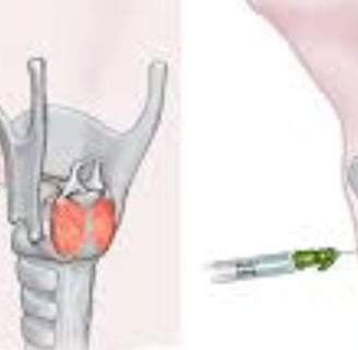 injection for laryngeal spasm
