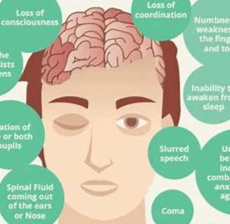 brain damage
