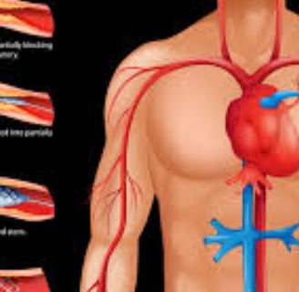 Cardiac Catheterization