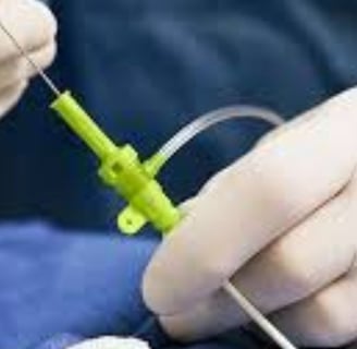 Cardiac Catheterization: Why Every Case Is Followed by a Stent