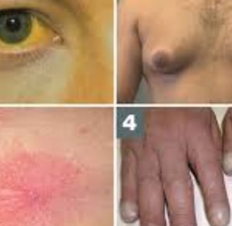 causes and symptoms liver skin