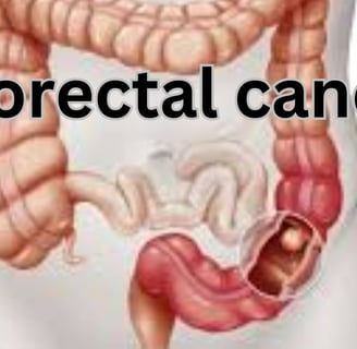 colorectal cancer
