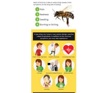 bee sting symptoms 