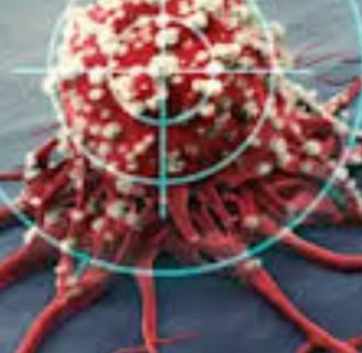 Curable Cancers And Effect Of Voluntary Fasting (4)