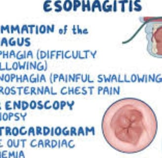 esophagitis