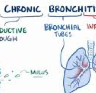 Bronchitis