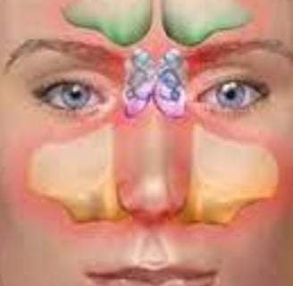 Dr. Hassan Al Warraqi's Approach to Disease Treatments Sinusitis