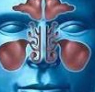 Effective Sinusitis Treatments Fasting & Honey