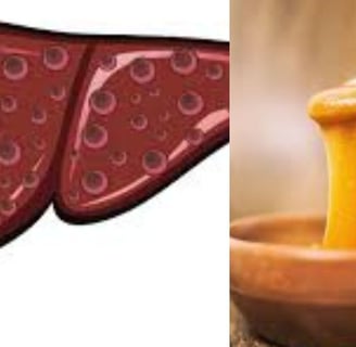 Esophageal Varices honey manouka and fasting