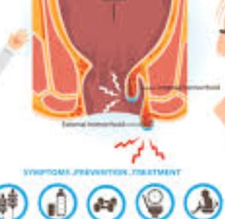 FAQs Natural Remedies for Anal Fissures and Fistulas Start with Honey and Fasting