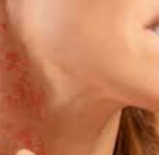 Fasting For Skin Allergies Itching & Pruritus