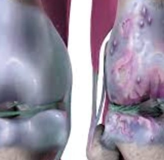 regeneration of cartilage