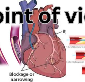 Heart Bypass, point of view