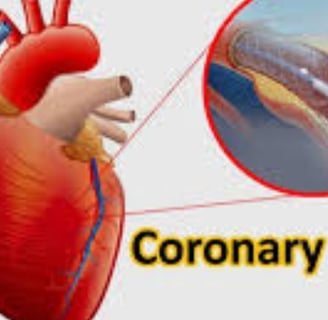 coronary angioplasty