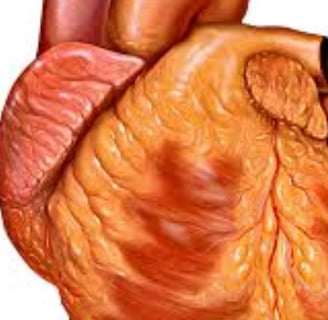 High heart index usually means that the heart has become enlarged