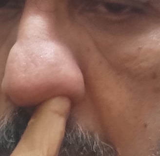 application of honey to the nose