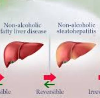 Fatty Liver Disease irreversable cirrosis