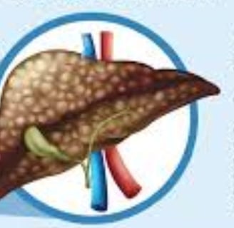 Fatty Liver Disease irreversable cirrosis