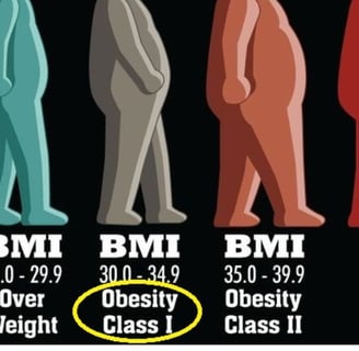 bmi