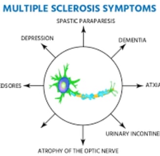 causes & symptoms multiple sclerosis
