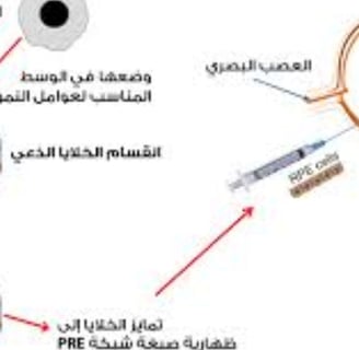 علاج العمى