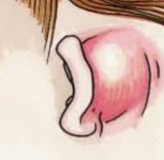 mastoiditis