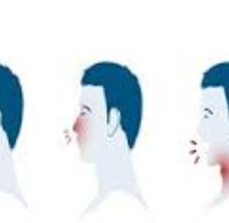 صداع التهاب بالانف كحة اعراض