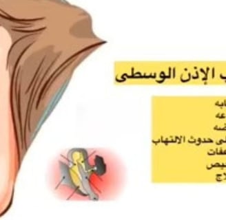 الاذن الوسطى الالتهاب