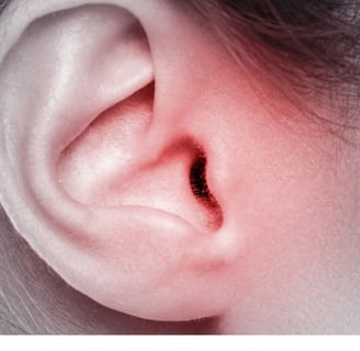 اعراض تسوس الاذن