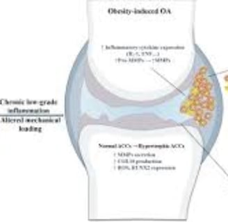 obesity damage the cartilage