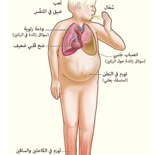 علامات امراض القلب