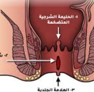 healing processes by reducing inflammation and providing a rest period for the digestive system.