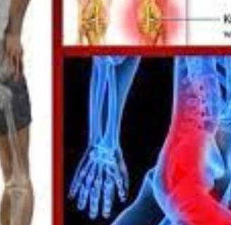 الألم المزمن الأسباب والعلاجات : الصيام وعسل النحل