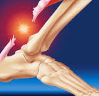achilles tendon