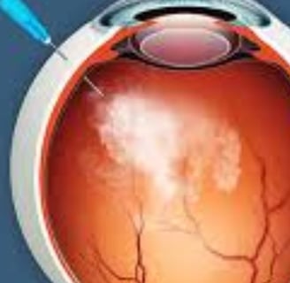 retinitis pigmentosa treatmen