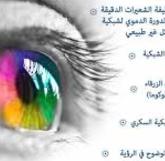 مشاكل العبن