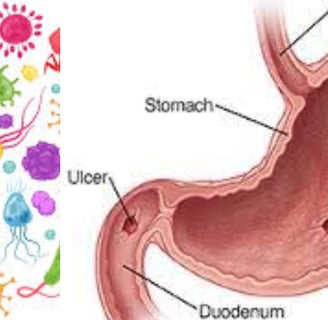 Stomach germ miracle healing of honey Monka honey and fasting