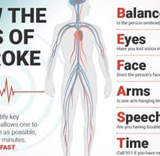 stroke signs