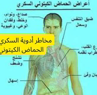 مخاطر أدوية السكري ومضاعفات الحماض الكيتوني - الصيام