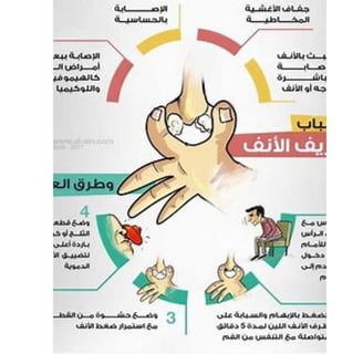 الاسباب