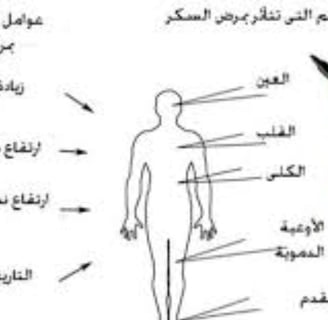 كيف يحدث السكرى