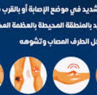 اعراض الكسر