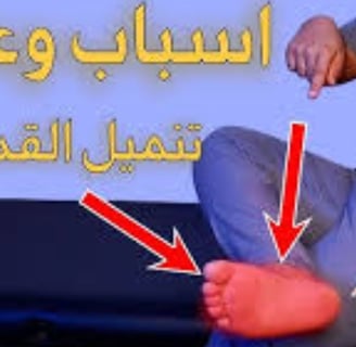 اسباب وعلاج تنميل القدمين