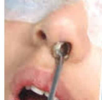 اعراض وجود جسم غريب